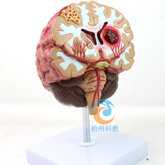 �X�����Y��ʾģ��