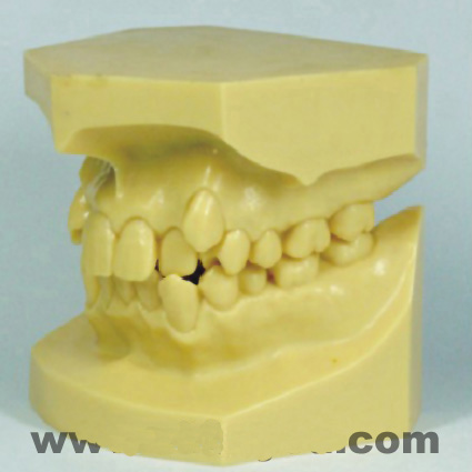 �e�M���η����ʾģ��A