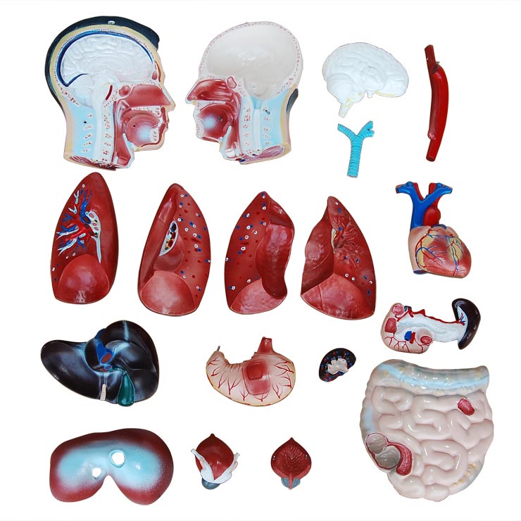 �����|��ģ��85cm��19����