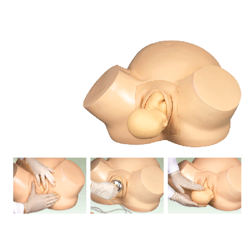 �߼����a(ch��n)Ӗ(x��n)��ģ��