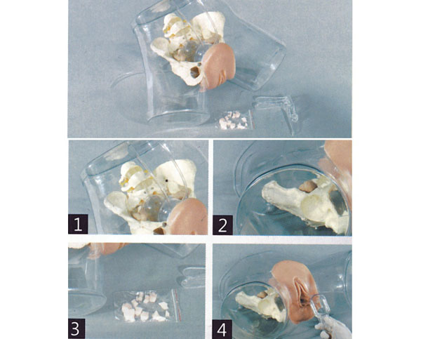 �߼�͸���Όmģ��