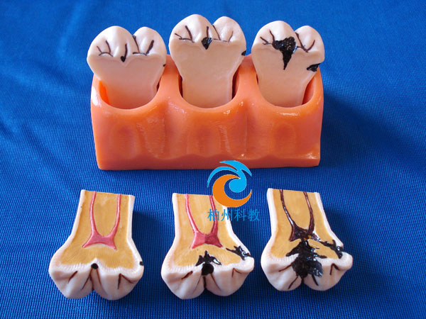 4���x�X�ֽ�ģ��