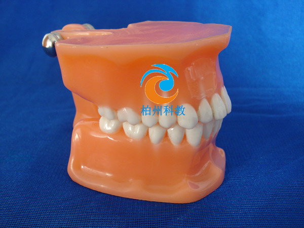 �pɫ����ģ�ͣ���frassaco�M�ܣ�