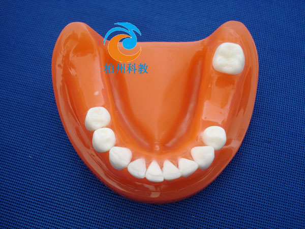 �pɫ����ȱʧģ��