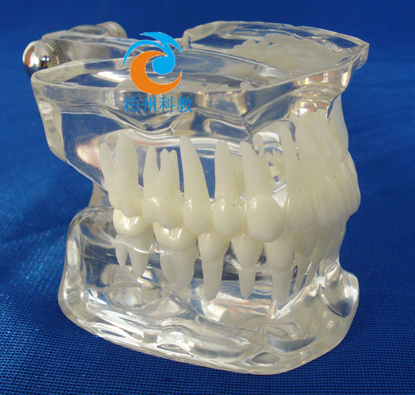 �˜�ˮ������ģ��(��frassaco�M��)