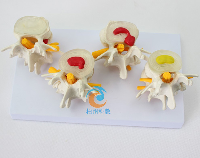 4�A�β��B(t��i)��׵���^ģ��