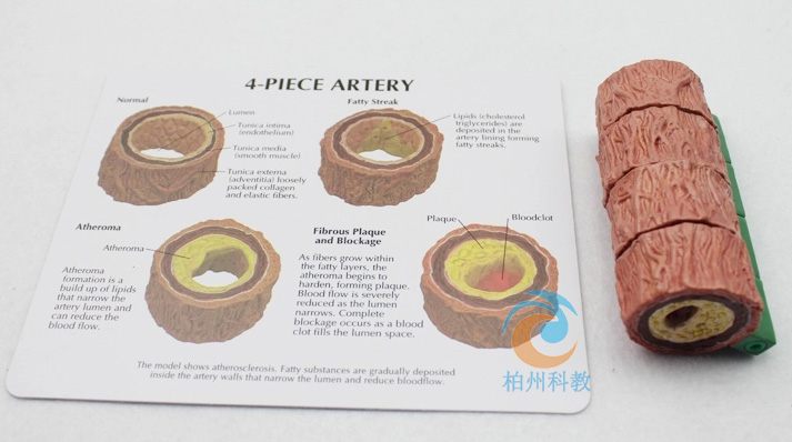 ��(d��ng)�}Ӳ����Ѫ˨ģ�ͣ����ͣ�