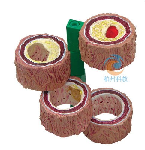 �ڠ���}����Ѫ�܄��}Ӳ��ģ��