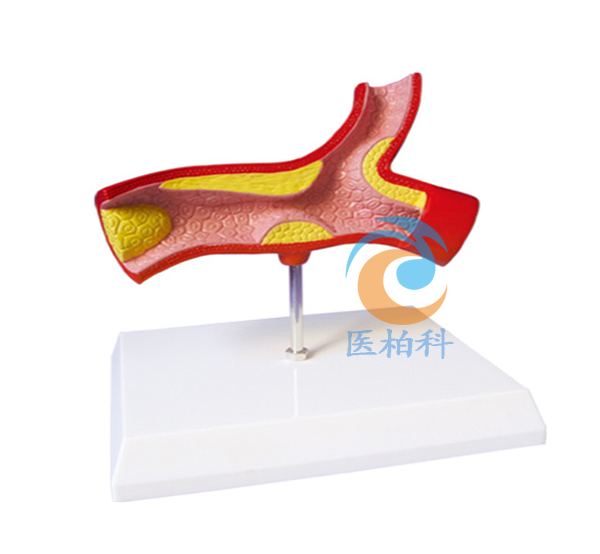 ���}Ѫ��ģ��